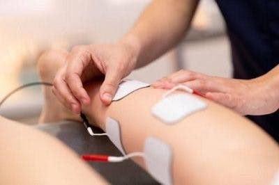 تحریک الکتریکی