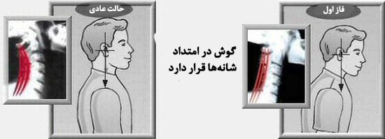 تعریف سر و گردن به جلو