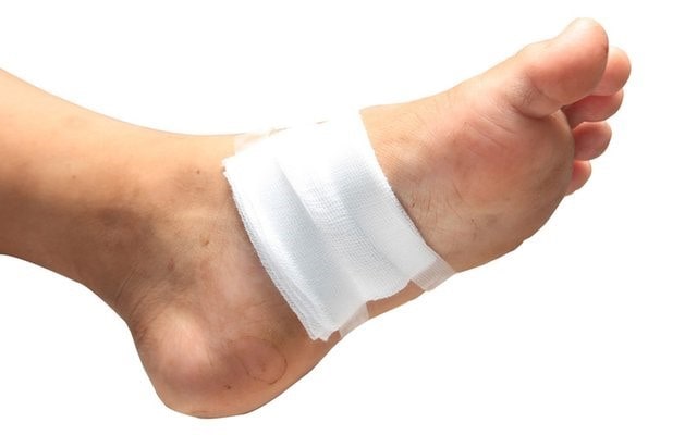 کنترل زخم پای دیابتی