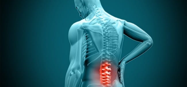 کاربردهای جراحی بسته ستون فقرات
