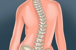 عوارض عمل جراحی اسکولیوز