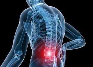 گودی کمر و افزایش قد درمان گودی کمر باعث افزایش قد میشود؟